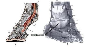 Síndrome Navicular: prováveis etiologias e meios de diagnóstico