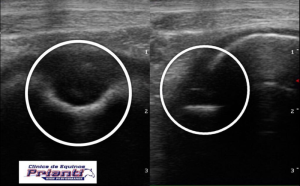 Cistos Condilares Femorais entre as causas da queda de performance