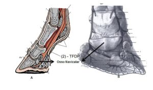 Diagnóstico da Síndrome do Navicular